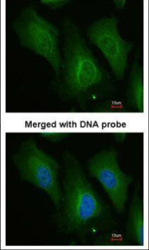 Anti-Dopamine beta hydroxylase Antibody | RayBiotech