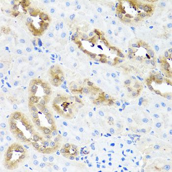 Anti-FABP5 Antibody | RayBiotech