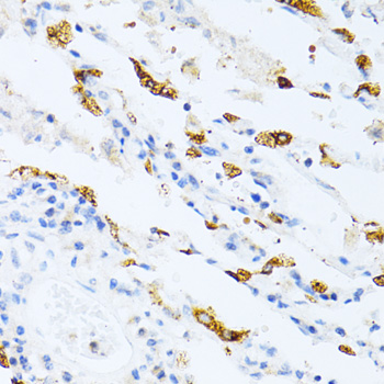 Anti-SFTPC Antibody | RayBiotech