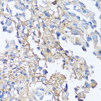 Anti-FN1 Antibody | RayBiotech