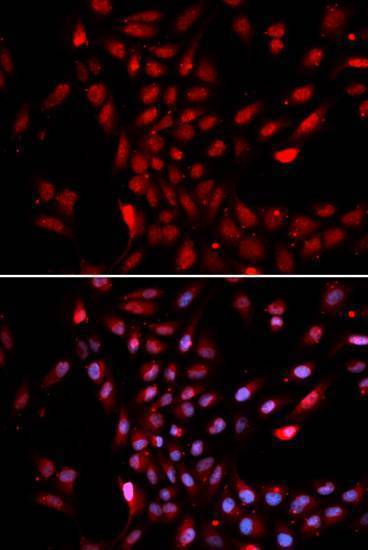 Rabbit anti-KPNA4 Antibody [144-02026]