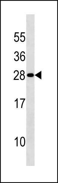 Anti-DENR (Center) Antibody | RayBiotech